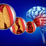 Boston Scientific Weaves a $1.16B Acquisition