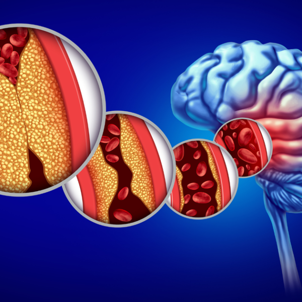 Boston Scientific Weaves a $1.16B Acquisition