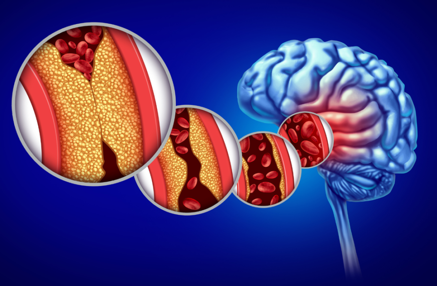 Boston Scientific Weaves a $1.16B Acquisition