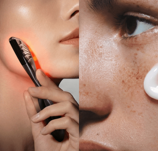High-Tech Glow-Up?Nuon Medical Unveils Diagnostic Beauty Tech at CES